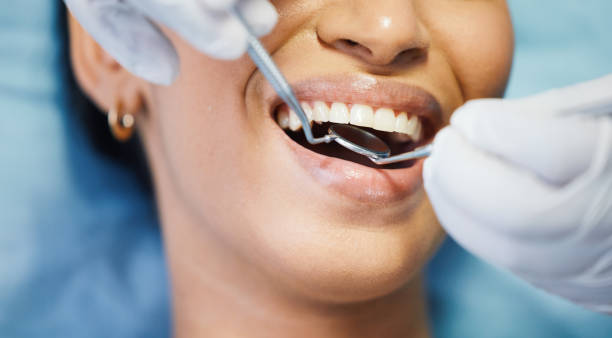 Best Emergency Denture Repair in Palm Springs North, FL