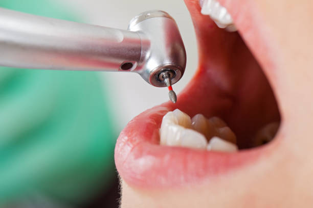 Best Emergency Treatment for Oral Infections in Palm Springs North, FL